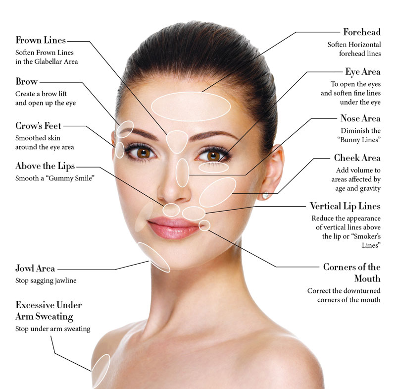best place for anti wrinkle injections in melbourne