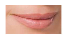Smiley Lips - Lip Enhancement
