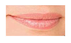 Smooth Lips - Lip Enhancement